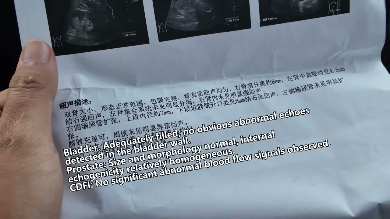 เปิดโลกชีวิตจริงคนขับรถบรรทุกส่งของในจีน: เบื้องหลังงานหนักและความหวังในเมืองใหญ่ - บทความจาก ITBlockman