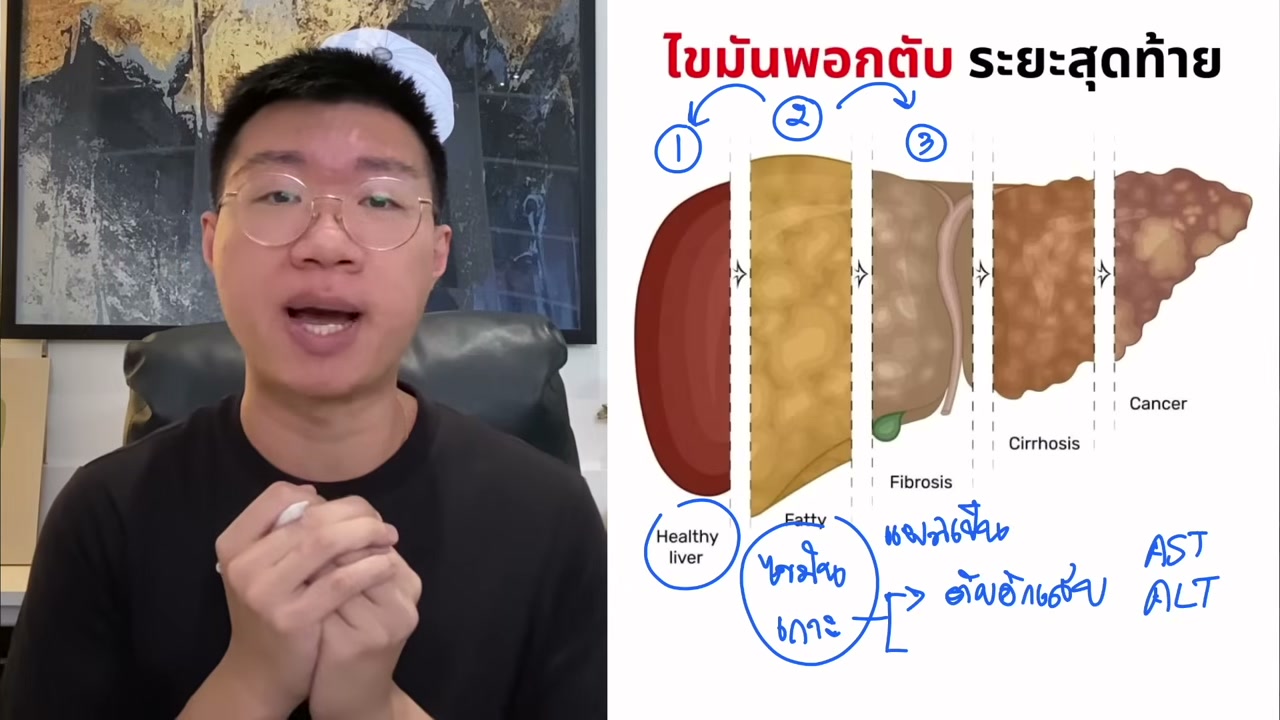 2 วิธีลดพุงและไขมันพอกตับ คืนตับสะอาดด้วยวิถีธรรมชาติ - บทความจาก ITBlockman